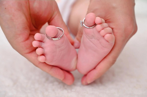 上杭孕妇怎样预防妊娠纹